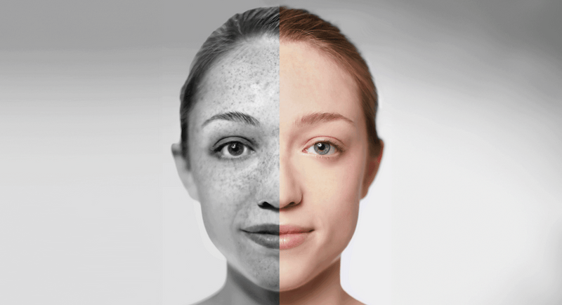 Skin Aging: The causes, effects, and how to slow it