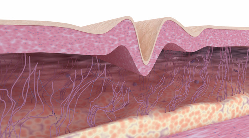collagen breakdown in aging skin
